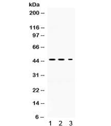 Neuroserpin Antibody