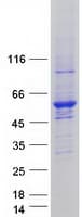 Human UBA3 / UBE1C Protein (Recombinant Myc-DDK (Flag))