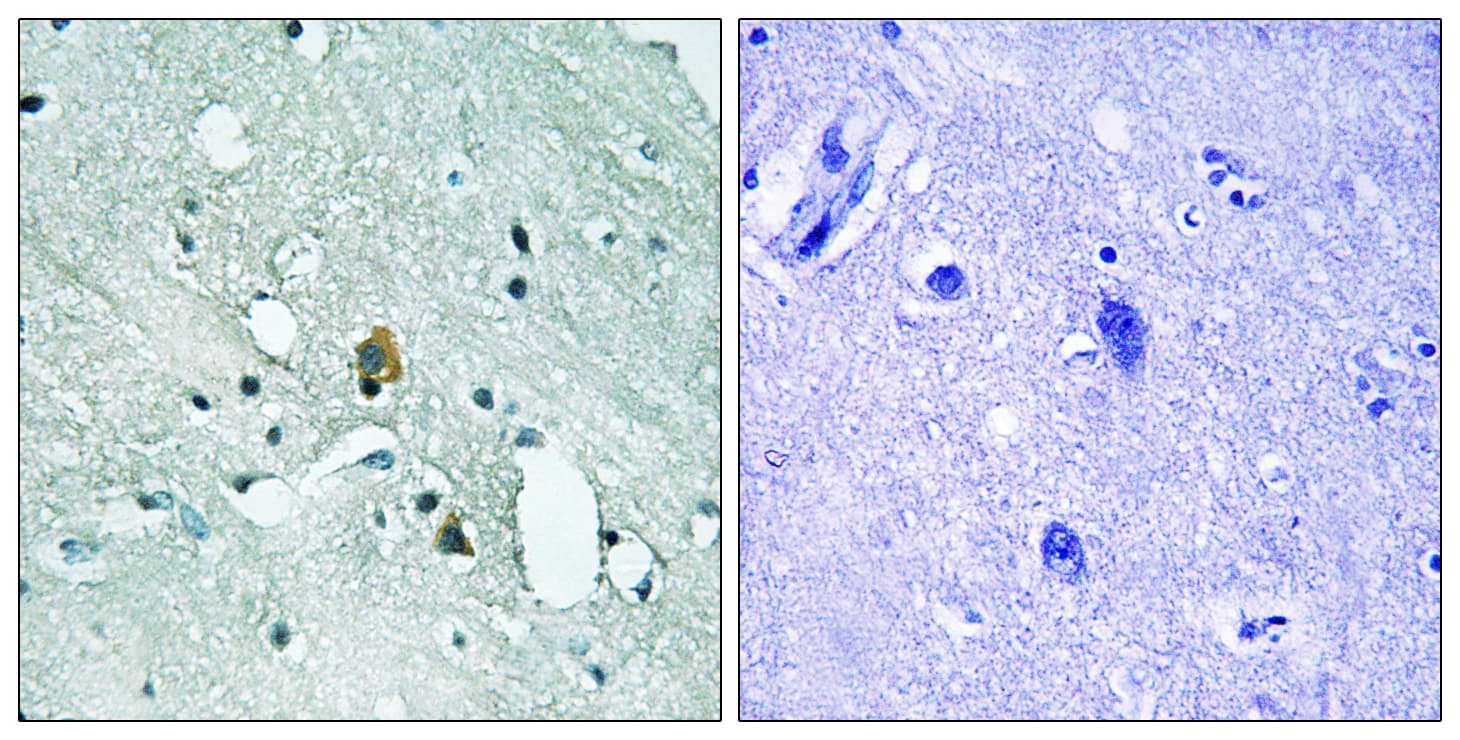 Polyclonal Rabbit anti-Human ITPR1 / IP3 Receptor Type 1 Antibody (phospho-Ser1764, IHC)