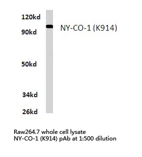 SDCCAG1 / NEMF Antibody (Lys914)