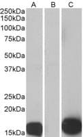 IHC-plus™ S100A7 / Psoriasin Antibody (aa18-30)