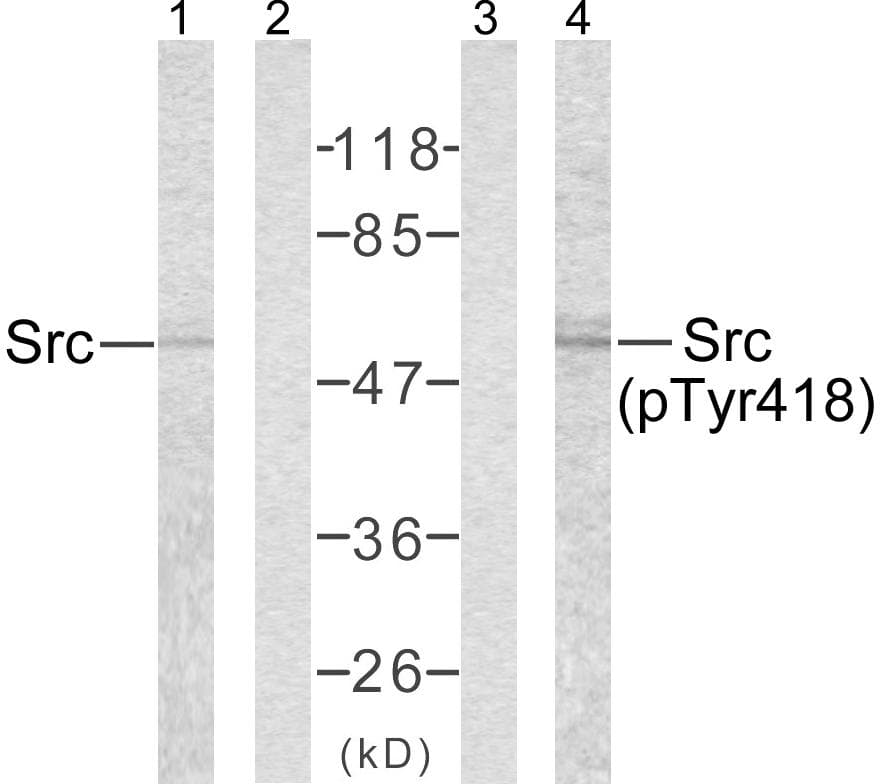 SRC Antibody (p418)