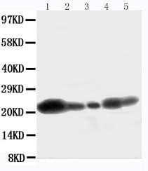 CAV1 / Caveolin 1 Antibody (aa164-178)