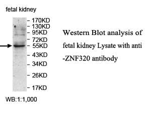 ZNF320 Antibody (aa147-404)
