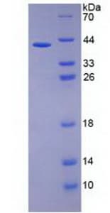 Human IL26 Protein (Recombinant His-GST, N-terminus)