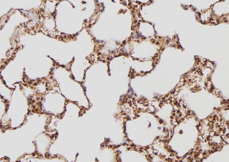Polyclonal Rabbit anti-Human TPT1 / TCTP Antibody (IHC, IF, WB)