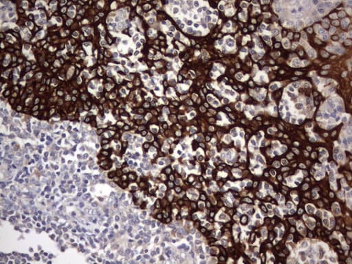 Monoclonal Rat anti-Human Acidic Cytokeratin Antibody (clone 2G10, IHC)