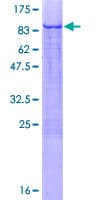Human ZNF449 Protein (Recombinant GST)