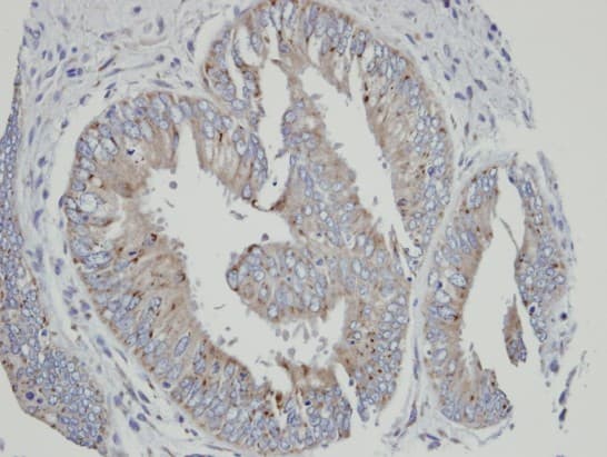 Polyclonal Rabbit anti-Human CYP4A11 Antibody (aa48-316, IHC, WB)