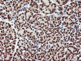 PIK3CG / PI3K Gamma Antibody (clone OTI6D1)