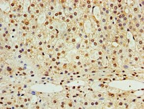STK32A Antibody (aa1-166)