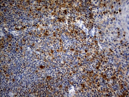 FHIT Antibody (clone OTI6B4)