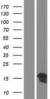 Human CC2D2A Protein (Over-Expression Lysate Myc-DDK (Flag))