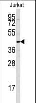 PTPN7 / HEPTP Antibody (Ser44)