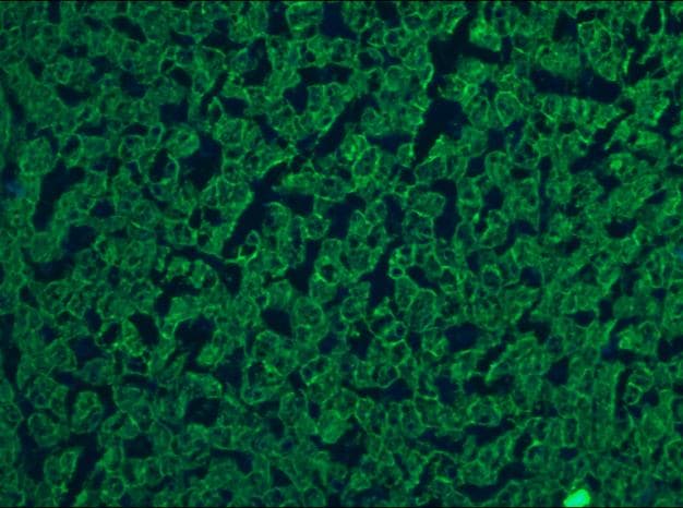 IHC-plus™ Cytokeratin 5+8 Antibody (clone RCK102)