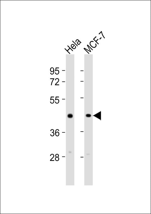 TGFB1 / TGF Beta 1 Antibody
