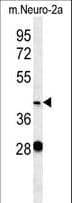Polyclonal Rabbit anti-Human VASH2 Antibody (aa216-245, WB)