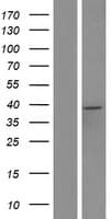 ACAA1 Protein (Over-Expression Lysate Myc-DDK (Flag))