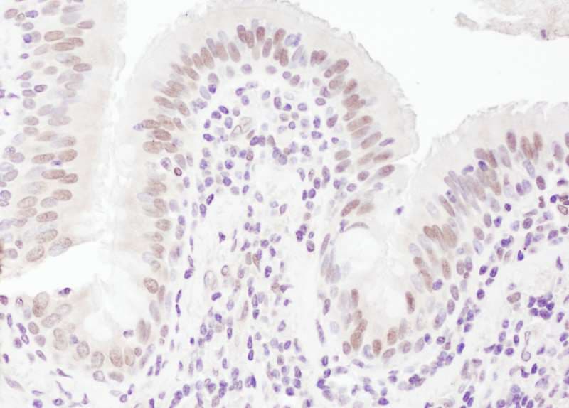 UHRF1 Antibody (aa275-325)
