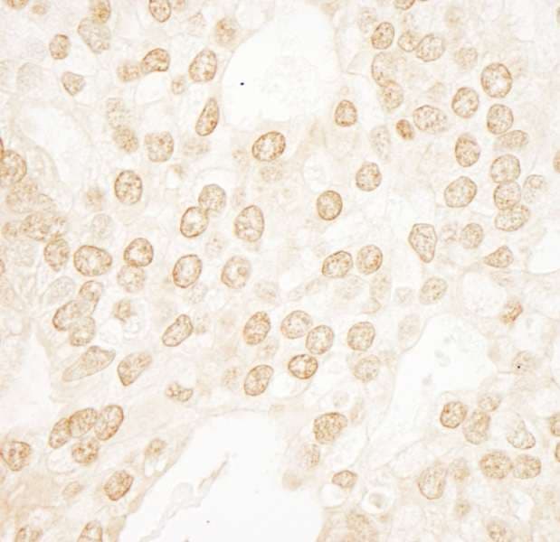 Polyclonal Rabbit anti-Human POLR3B Antibody (aa1083-1133, IHC, WB)