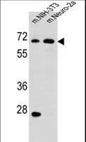 Polyclonal Rabbit anti-Human ME2 / Malate Dehydrogenase 2 Antibody (aa527-556, IHC, WB)
