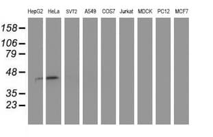 SMS / Spermine Synthase Antibody (clone OTI5E5, Carrier-free)