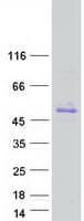 Human GNAS Protein (Recombinant Myc-DDK (Flag))
