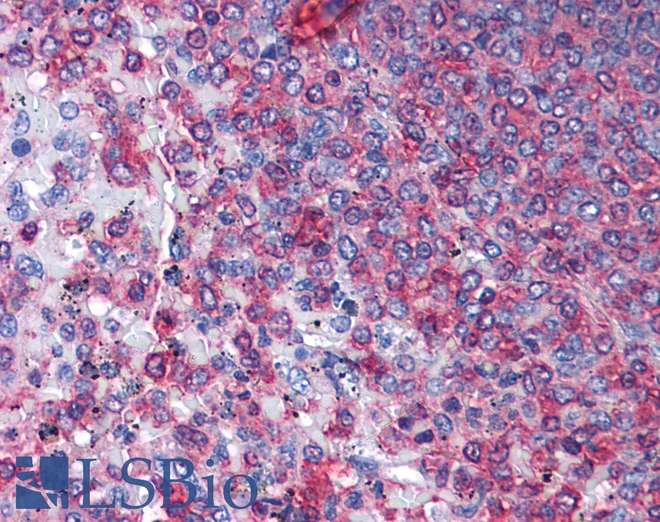 IHC-plus™ Polyclonal Rabbit anti-Human ACTG1 / Gamma Actin Antibody (IHC, WB)