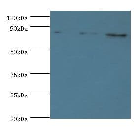 ATRIP Antibody (aa1-260)