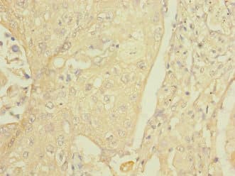 FCRL2 / IRTA4 Antibody