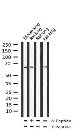 PTPN6 / SHP1 Antibody (phospho-Tyr536)