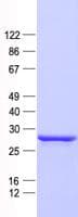 Human PRPK / TP53RK Protein (Recombinant His, N-Terminal)