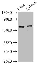 Polyclonal Rabbit anti-Human RICK / RIP2 Antibody (WB)