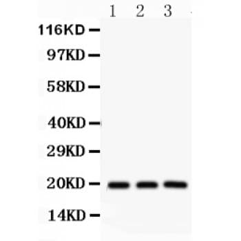 SRSF3 / SRP20 Antibody (aa1-29)