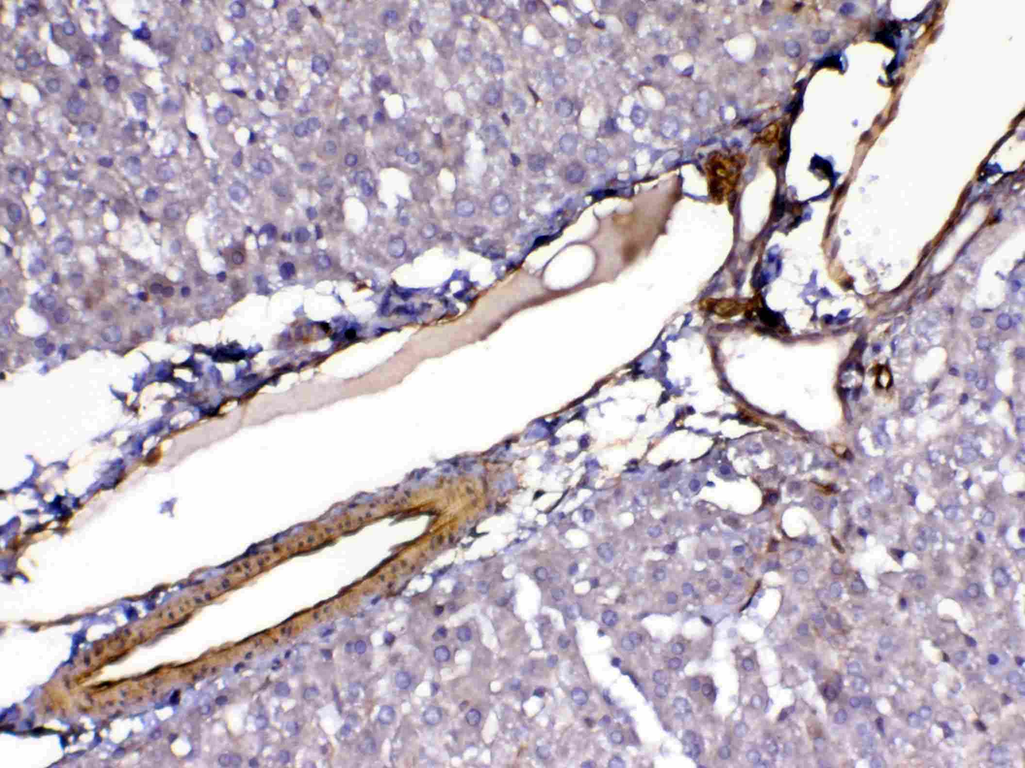 Polyclonal Rabbit anti-Human FLT4 / VEGFR3 Antibody (IHC, WB)