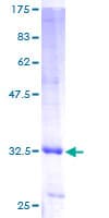 Human UBE2Q1 Protein (Recombinant GST)