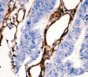 HSPB1 / HSP27 Antibody