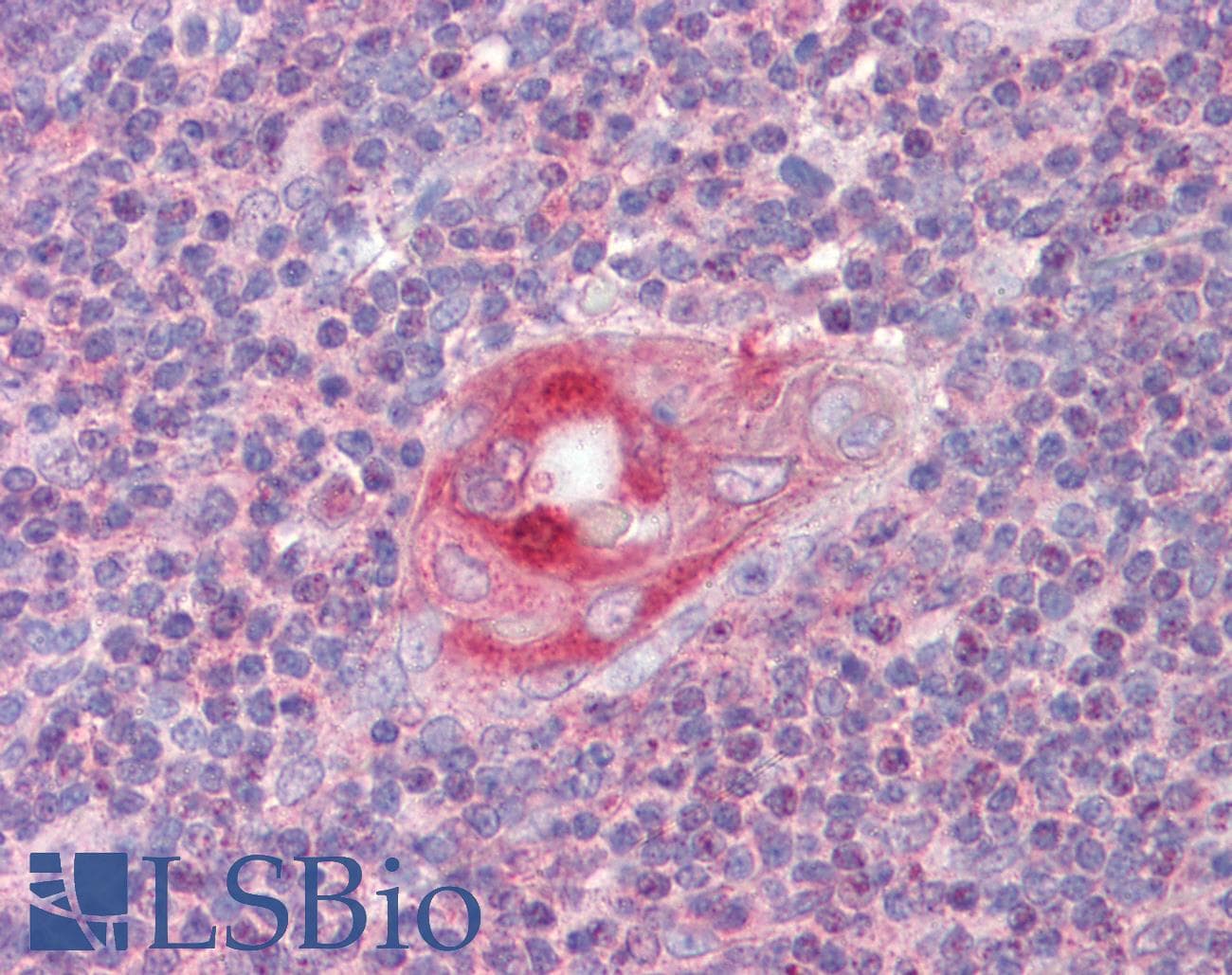 IHC-plus™ RGS1 Antibody (aa198-209)