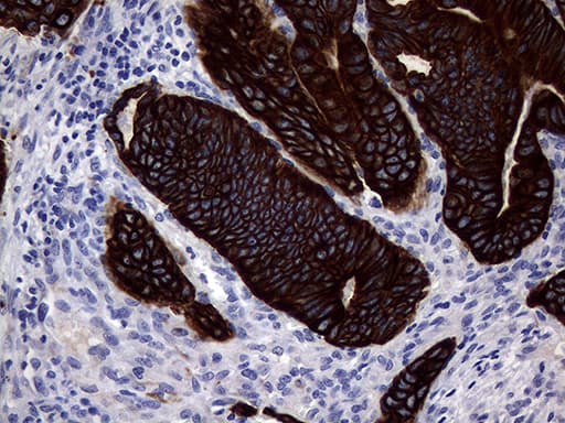 KRT18 / CK18 / Cytokeratin 18 Antibody (aa69-372, clone OTI10H8)