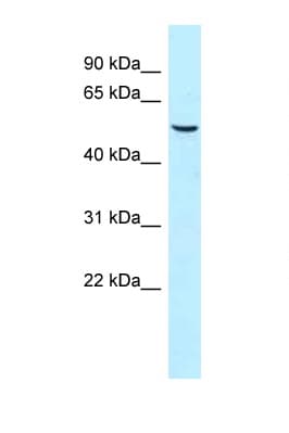 Polyclonal Rabbit anti-Human SNX8 Antibody (aa348-397, WB)