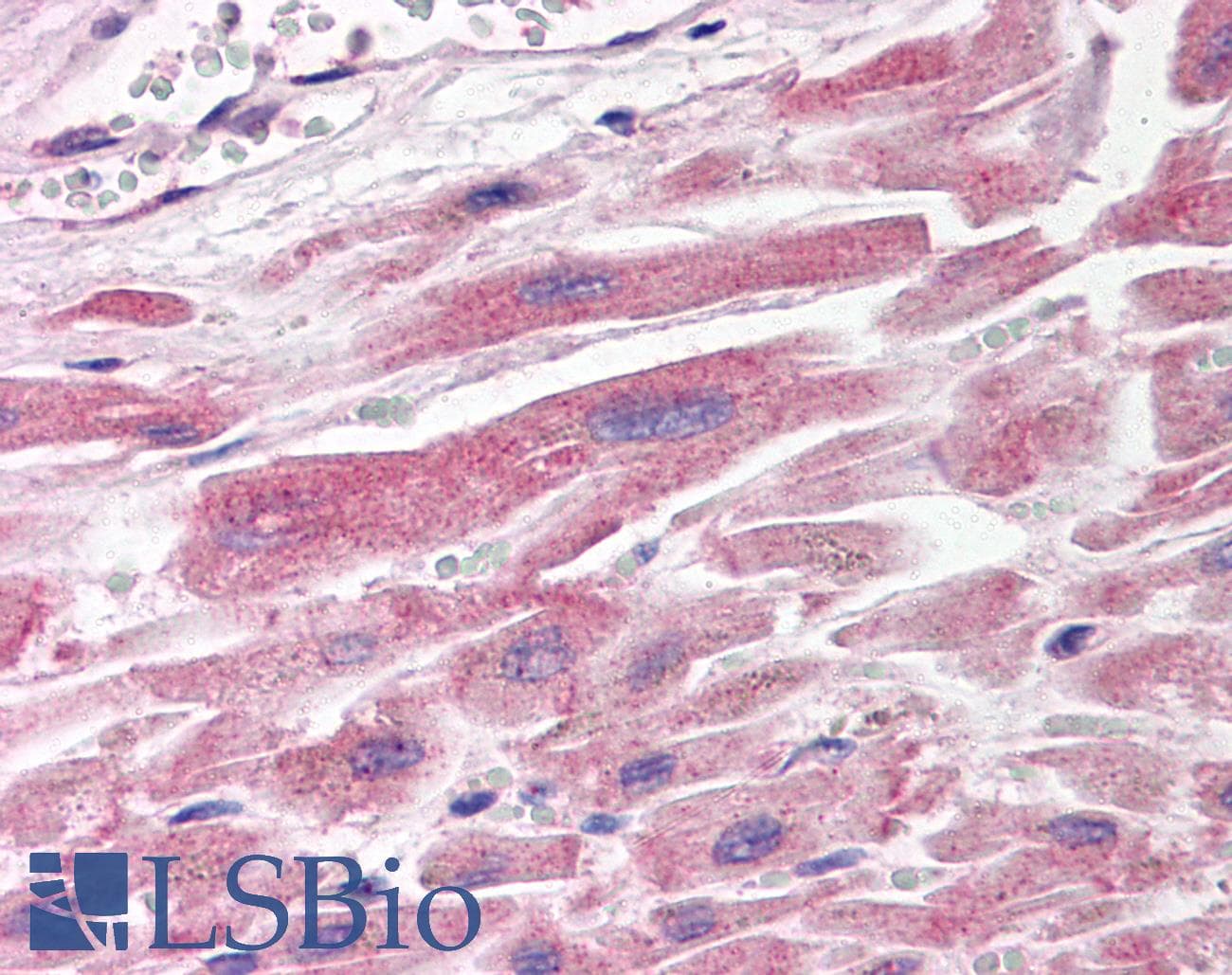 IHC-plus™ Polyclonal Rabbit anti-Human SH3GLB1 / Bif / Endophilin B1 Antibody (IHC, WB)