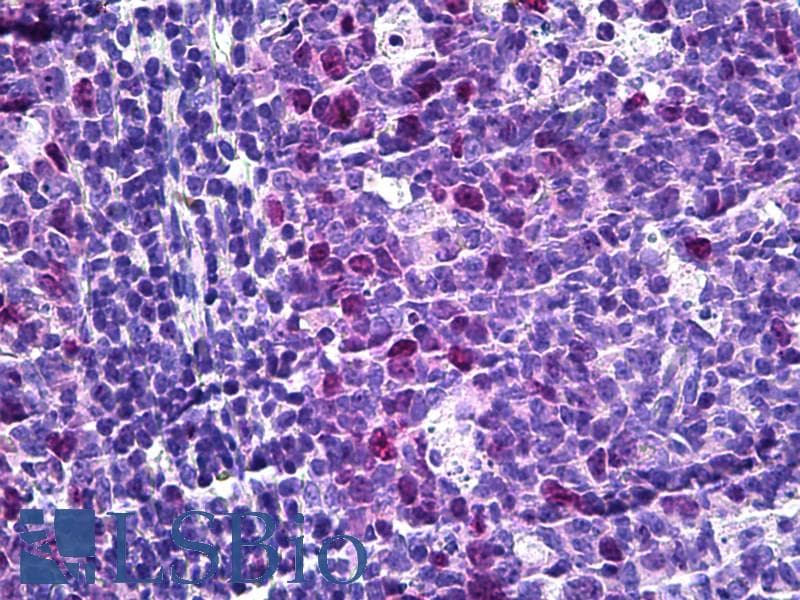 IHC-plus™ TPX2 Antibody (aa301-350)