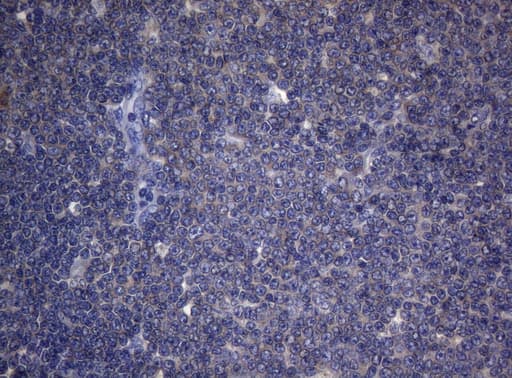 CDCA8 / Borealin Antibody (clone OTI7G7)