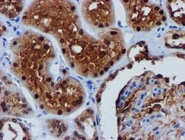 FBXO21 Antibody (clone OTI5H4)
