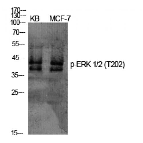 Polyclonal Rabbit anti-Human ERK1 + ERK2 Antibody (140-220 aa, WB)