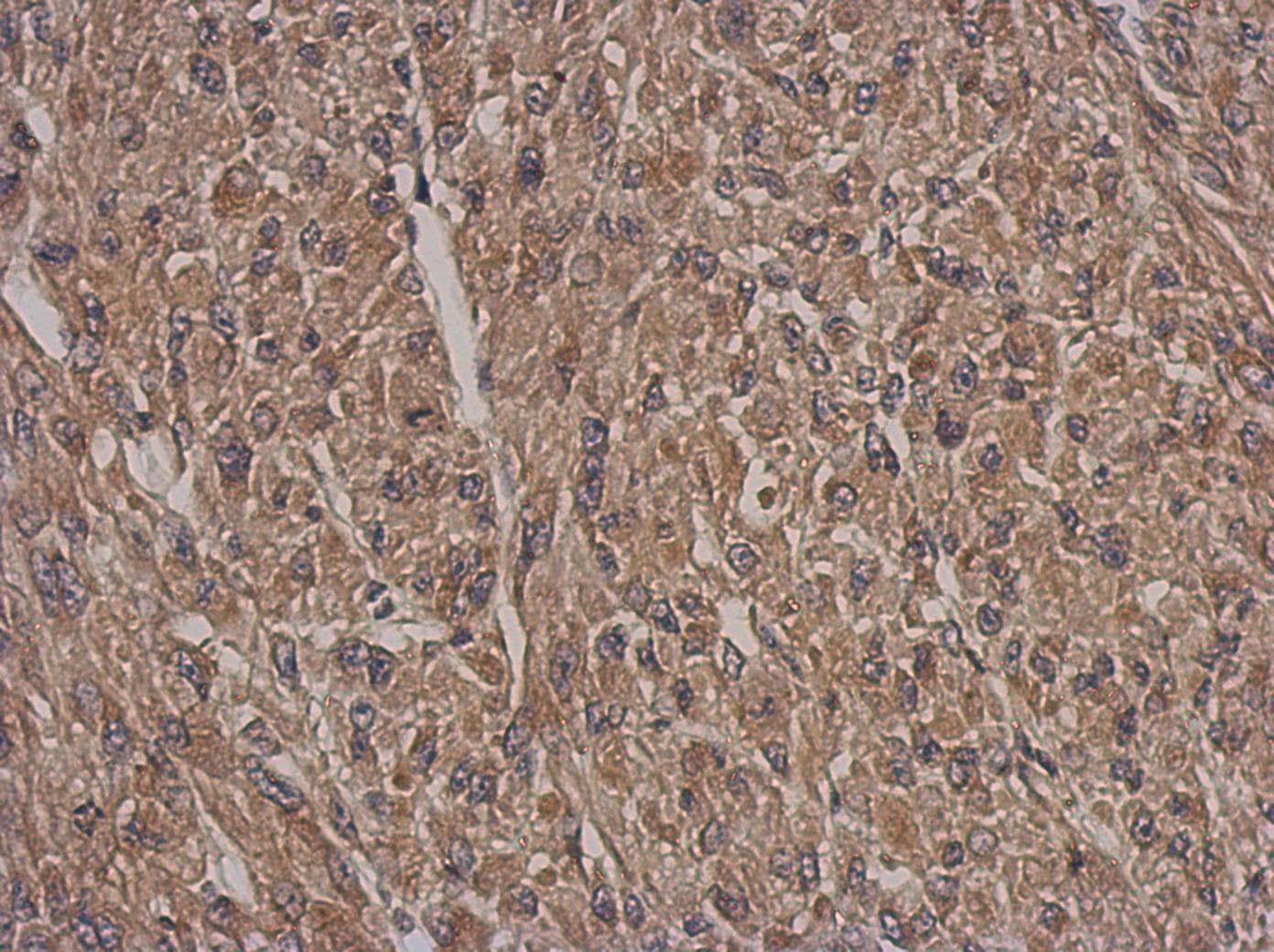HSF2BP Antibody