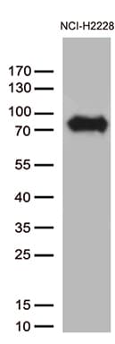 CSF2RA / CD116 Antibody (aa23-320, clone OTI2D6)