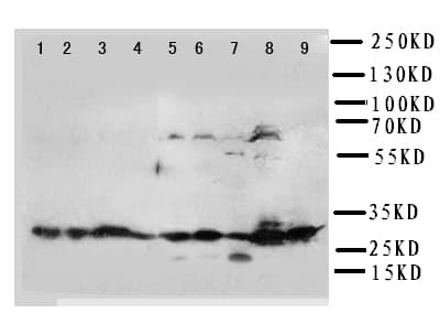 KLK6 / Kallikrein 6 Antibody (aa227-244)