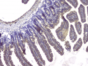 HDAC5 Antibody