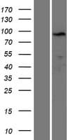 PPP1R21 / KLRAQ1 Protein (Over-Expression Lysate Myc-DDK (Flag))